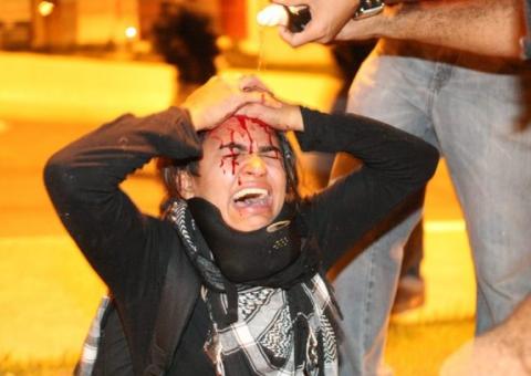 Vídeo: Após levar golpe de PM, mulher tem a cabeça cortada durante manifestação